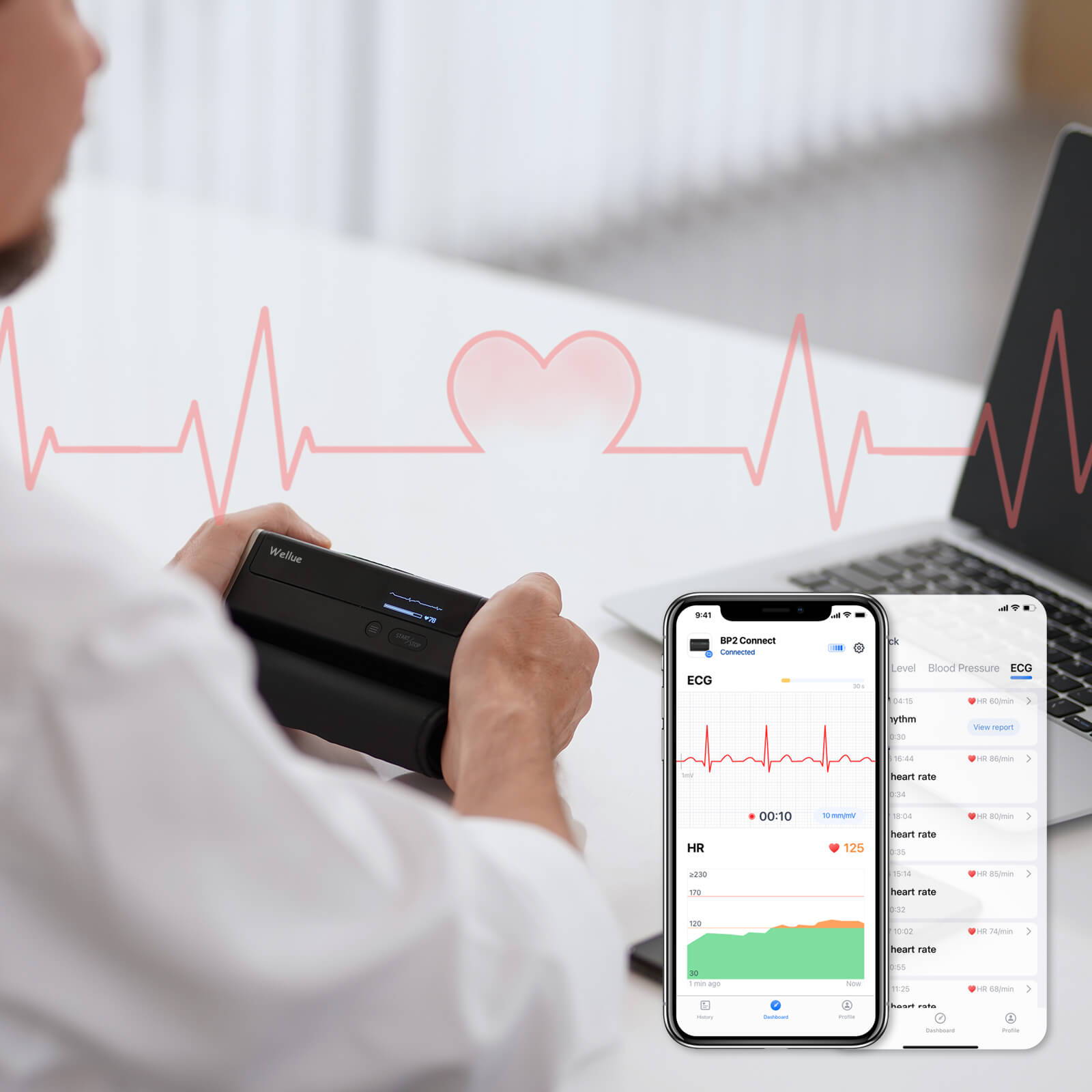 Sfigmomanometro Wi Fi con ECG. Media di 3 letture della pressione sanguigna sincronizzazione Bluetooth e WiFi Wellue